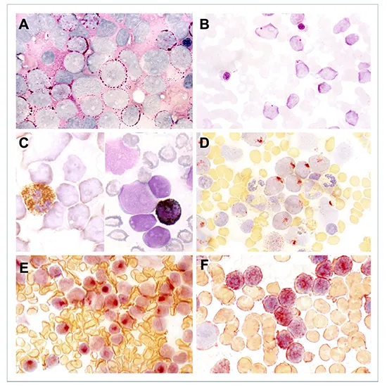 Leukemia Cytochemistry Panel
